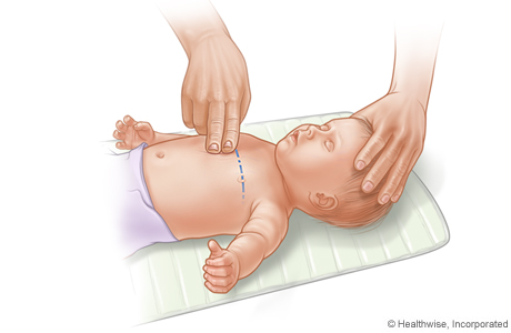 How many chest compressions in cpr for adults